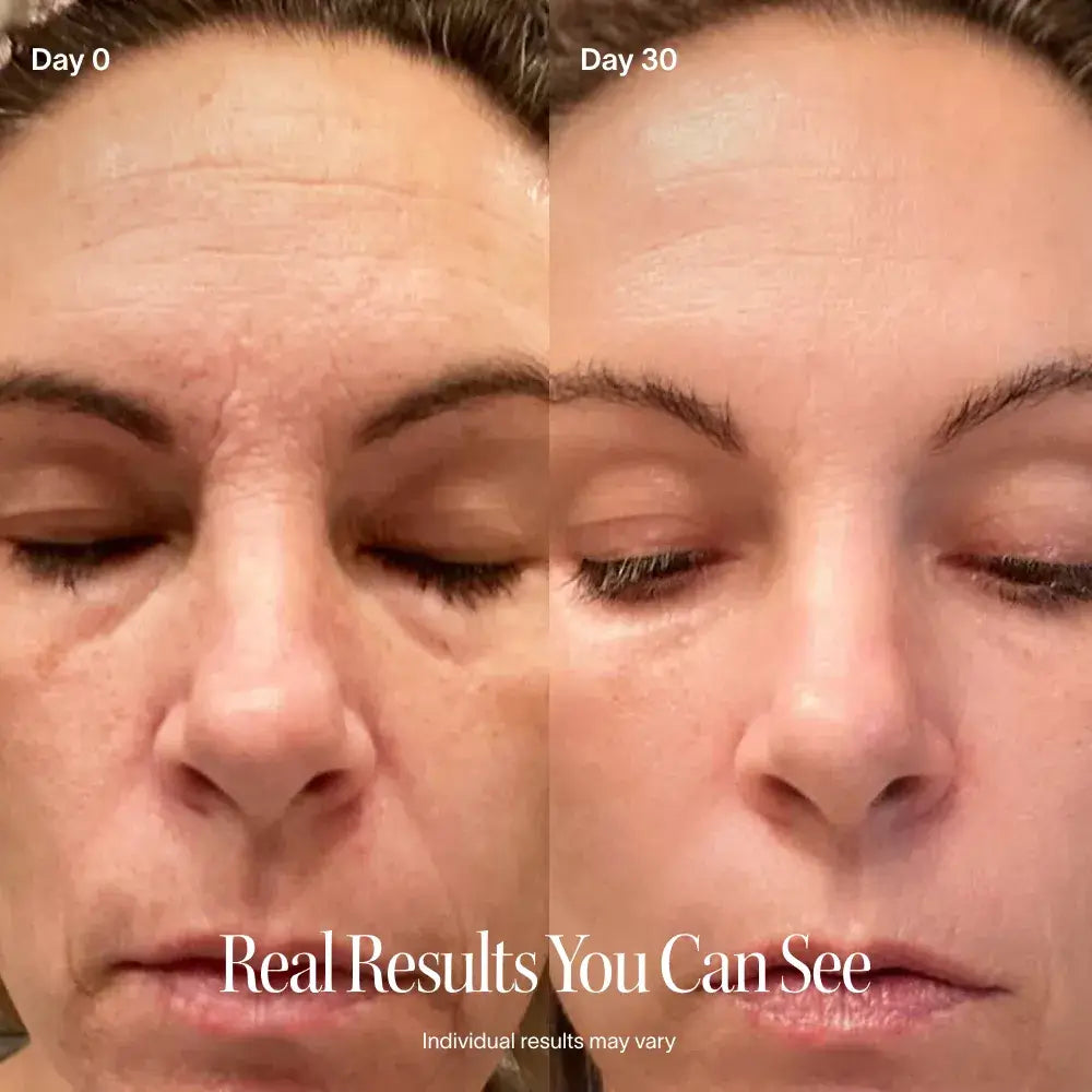 This award-winning Skincare Wand uses 4 advanced technologies to visibly soften fine lines, boost radiance, and refresh tired skin. With a rotating head and built-in timer, you're in control of where results appear. After 8 weeks, visibly reduces: Fine li