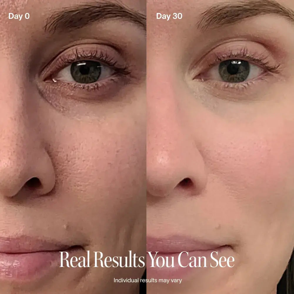 This award-winning Skincare Wand uses 4 advanced technologies to visibly soften fine lines, boost radiance, and refresh tired skin. With a rotating head and built-in timer, you're in control of where results appear. After 8 weeks, visibly reduces: Fine li