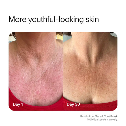 Your neck and chest are some of the first places to show sun damage, loss of elasticity, and uneven tone – yet they’re often the last to be treated. This mask pairs Red and Near-Infrared Light Therapy to visibly firm, smooth, and even this delicate area.