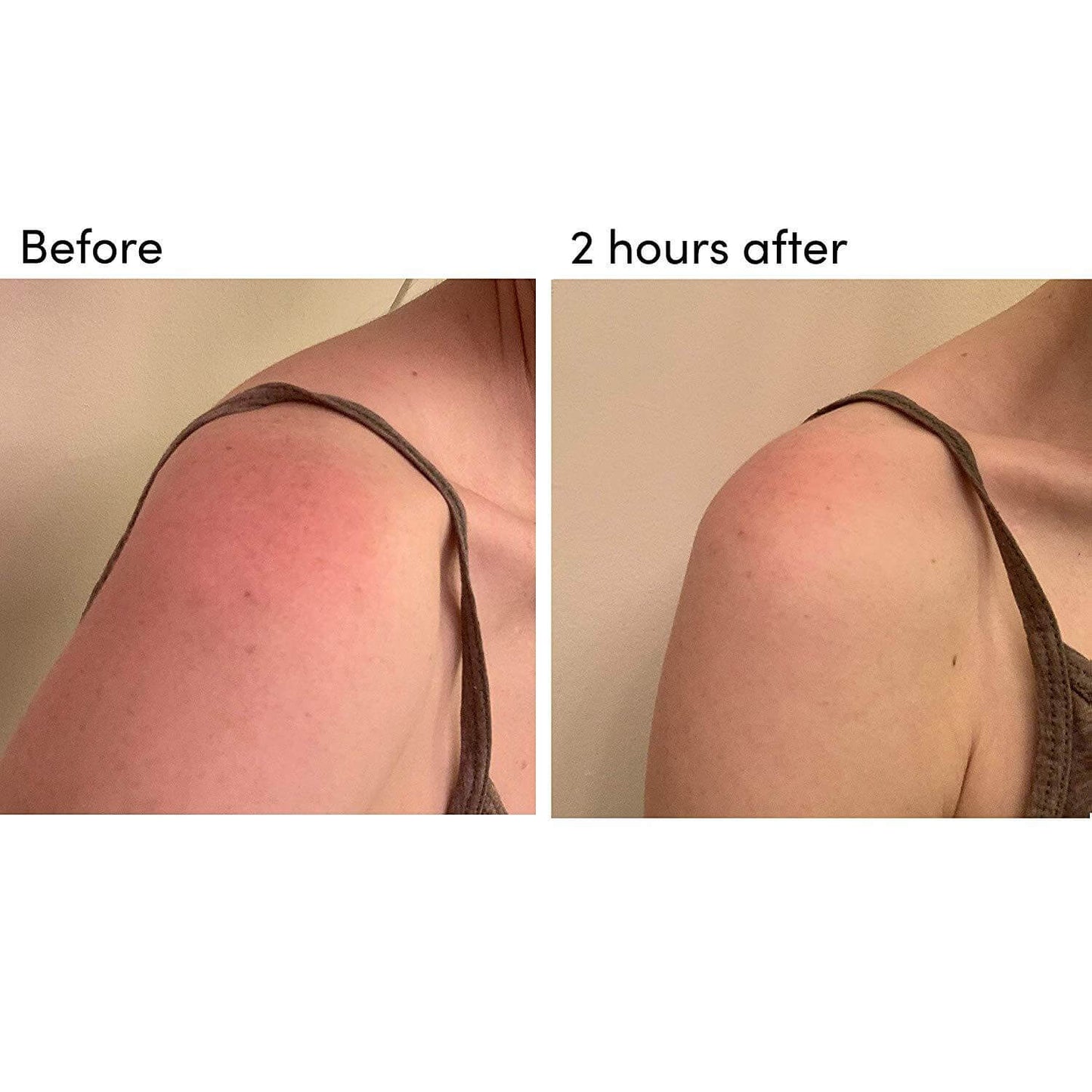 MAIN BENEFITReduces redness without the stinging. ADDITIONAL BENEFITSReduces redness.Soothes skin.No goopy gel.The first wipe dedicated to aloe for both face + body. Say ahhh.Soothe + Moisturize + RepairRECESS After Sun Aloe wipes soothe + moisturize sunb