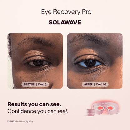 An easy 3-minute reset for tired eyes. Target signs of aging in the delicate eye area using 4 wavelengths to visibly brighten dark circles, reduce puffiness, and restore a refreshed, brighter look. Built to power your routine without slowing you down. Aft